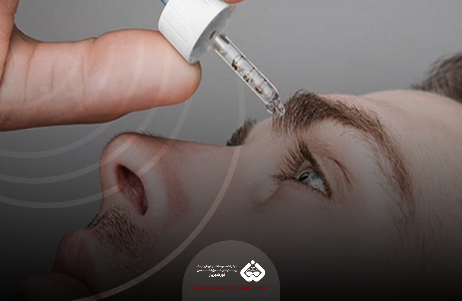 بیماریهای چشمی بیرون زدگی چشم سیتومگالوویروس کوررنگی انحراف چشم و قوز قرنیه