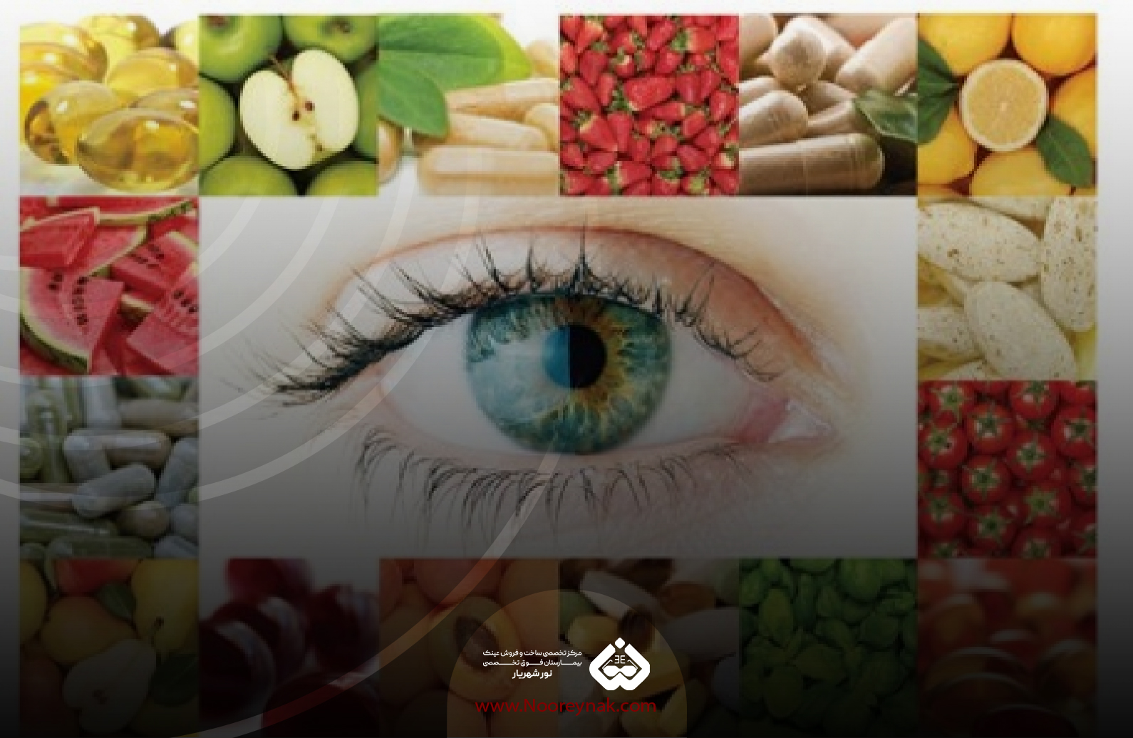 نتیجه‌ گیری در مورد دژنراسیون ماکول