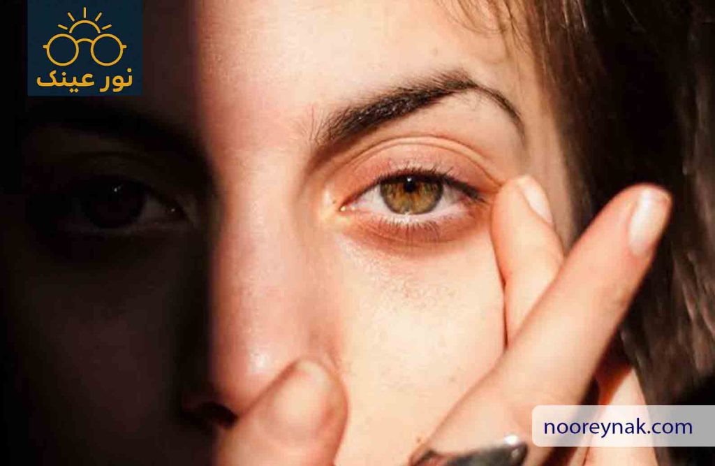 شماره تلفن متخصص چشم پزشکی در شهریار